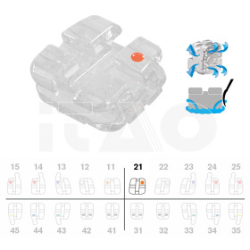 Brackets DB Agility Ceramic MBT .022" UL1 5pz.