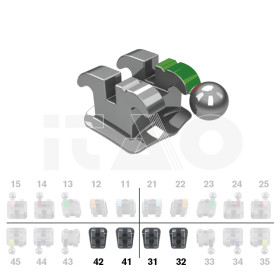 Brackets DB Ricketts Actual...