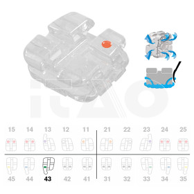 Brackets DB Agility Ceramic...